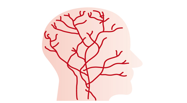 頭の血管